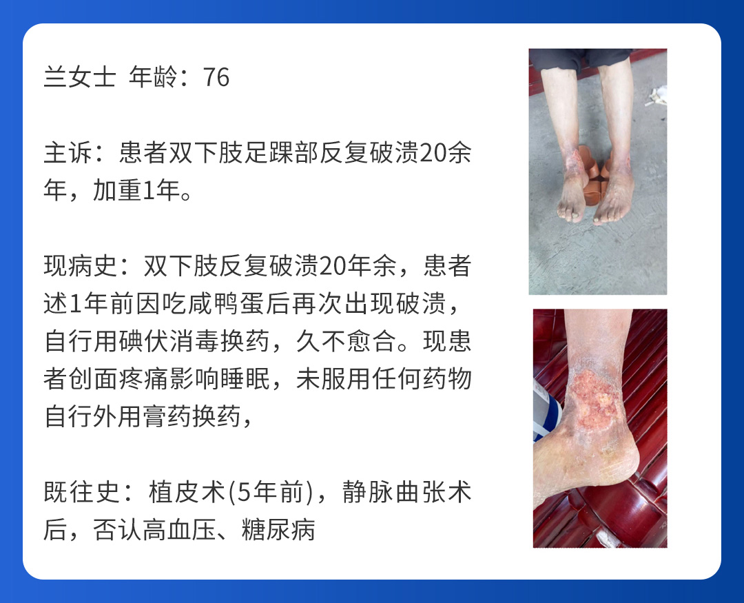 【北京市中西医结合周围血管疑难病会诊中心】第二期会诊圆满成功！(图6)